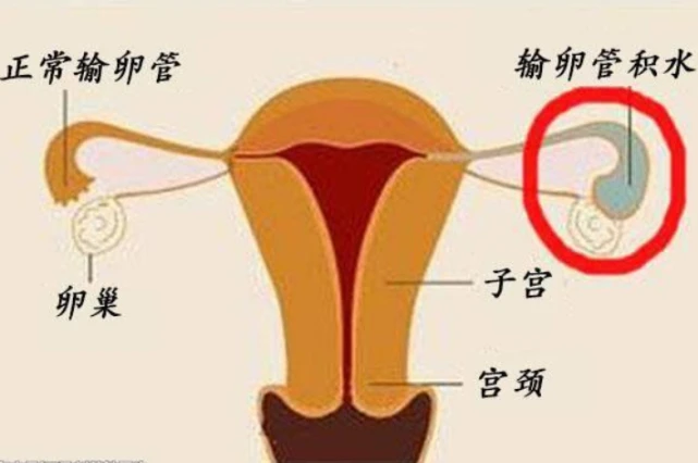 不孕不孕哪家医院好_不不育不孕_不孕不育