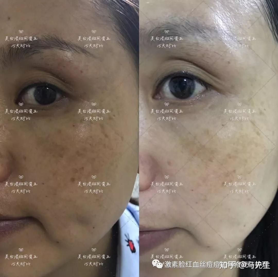 化妆品_化妆品备案_化妆品工厂货源